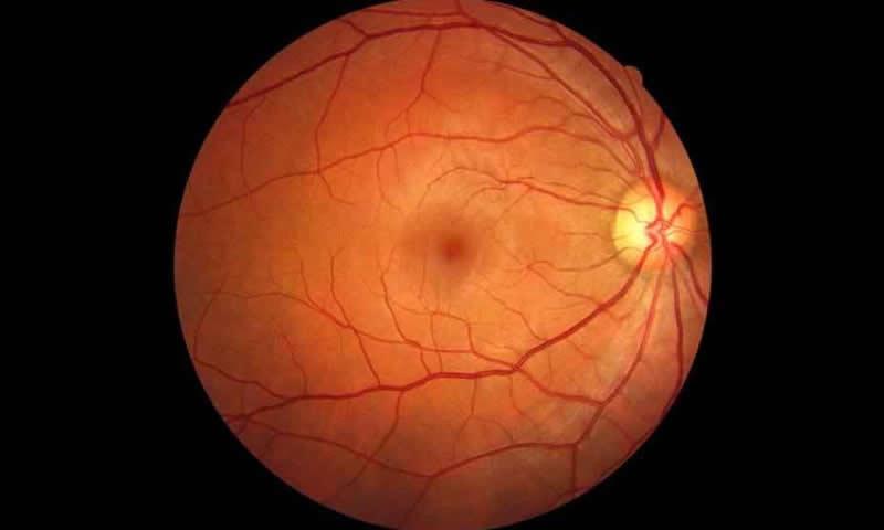 Retina saudável: saiba porque isso é importante